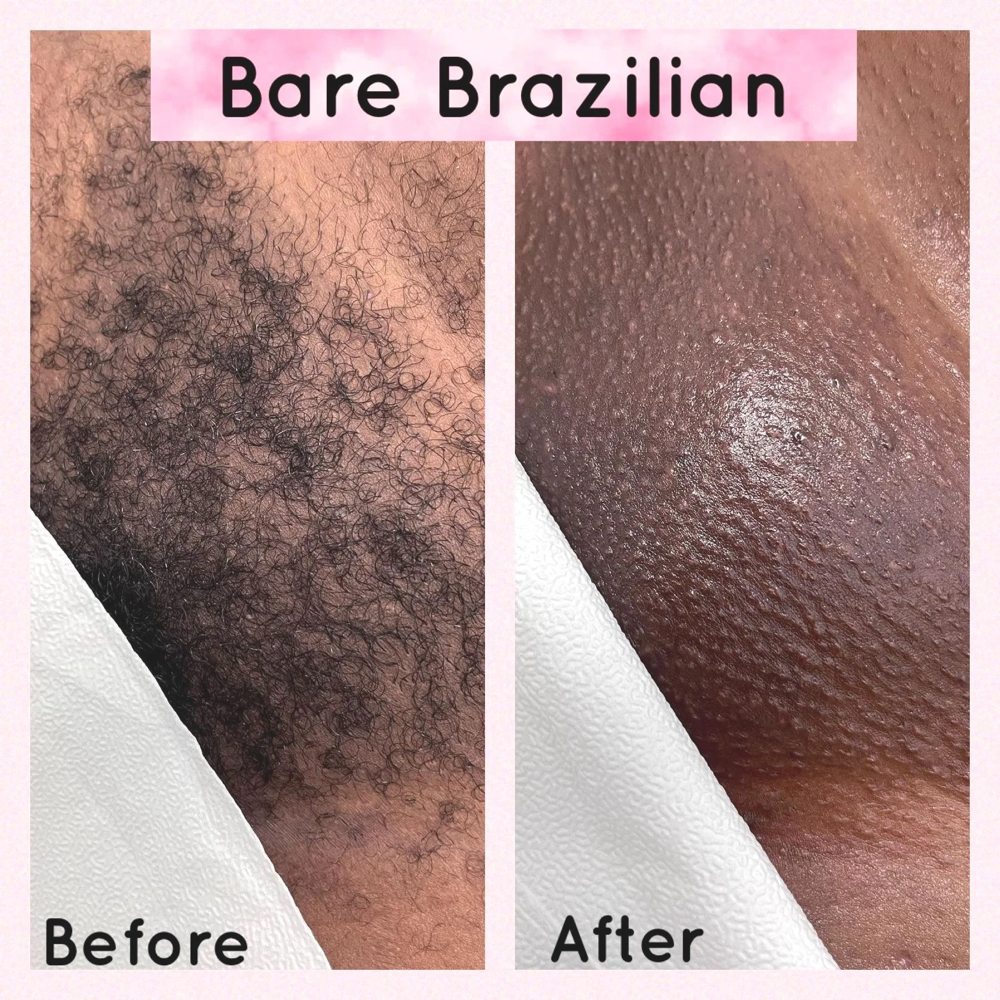 Full Brazilian Sugar Wax