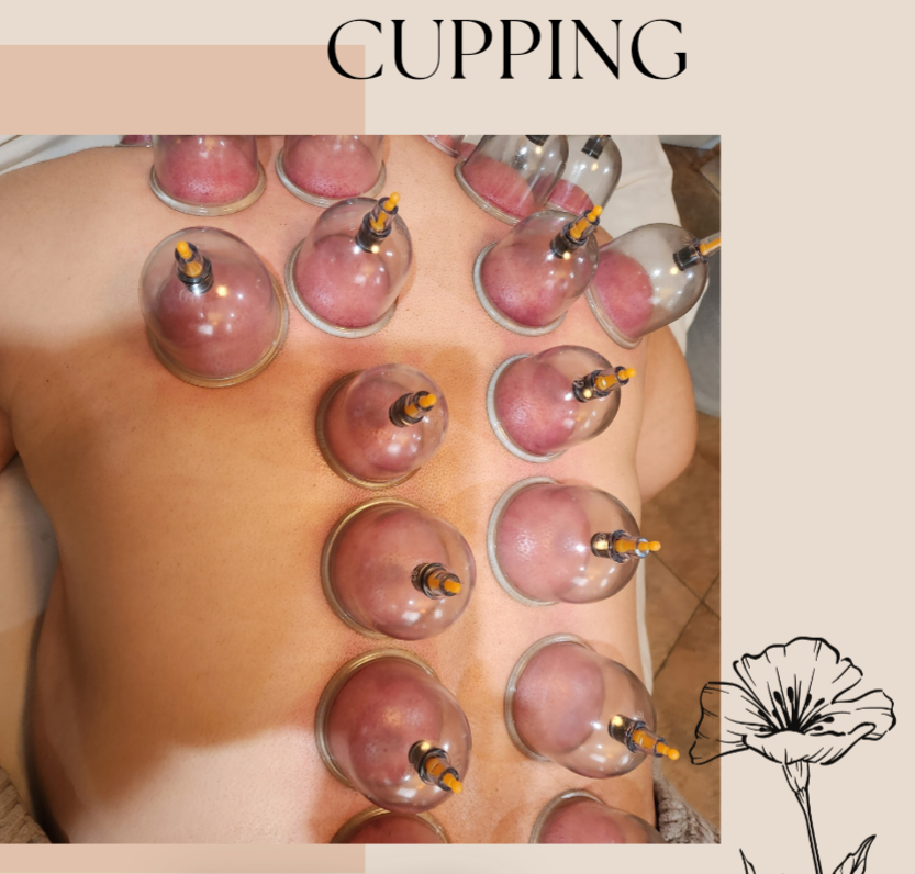 Cupping