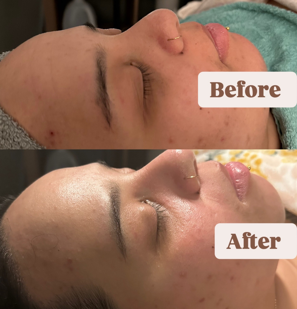 Revitalize and Brighten Facial