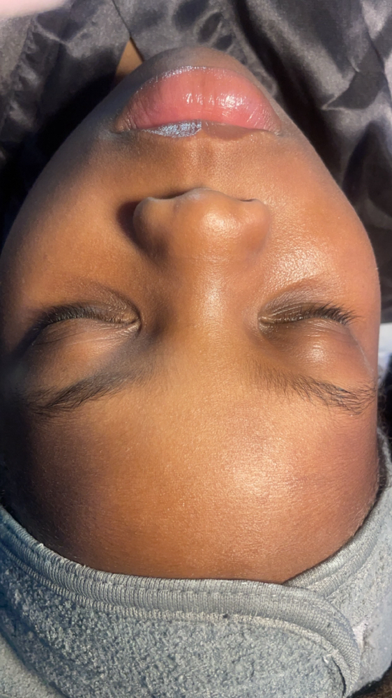 Teen (🌞) Facial (back To School Pr