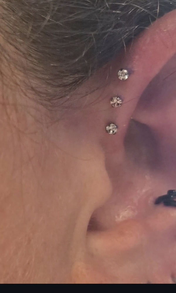 Forward Helix x 1