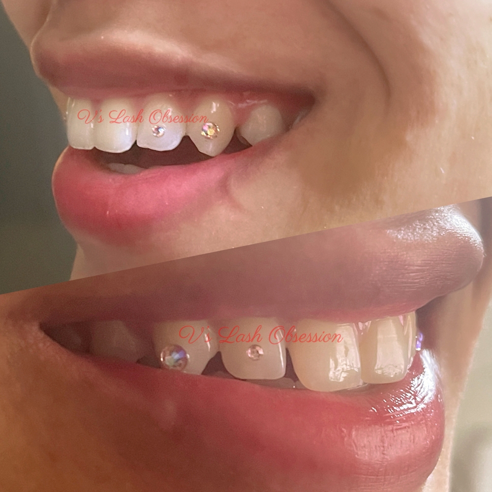 Single Tooth Gem