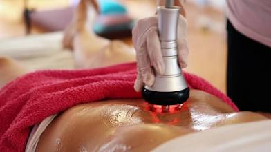 RF Skin Tightening (body)