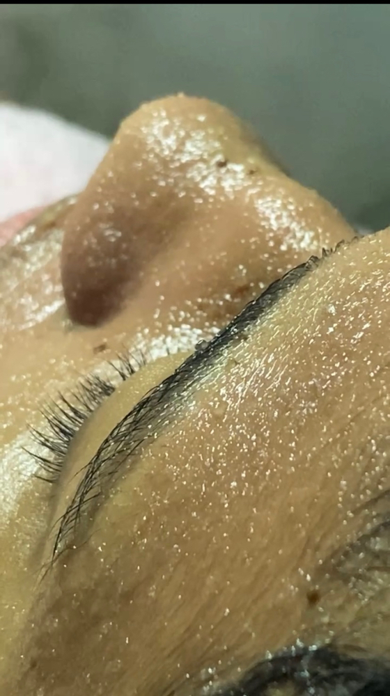 Facial Enzimatico