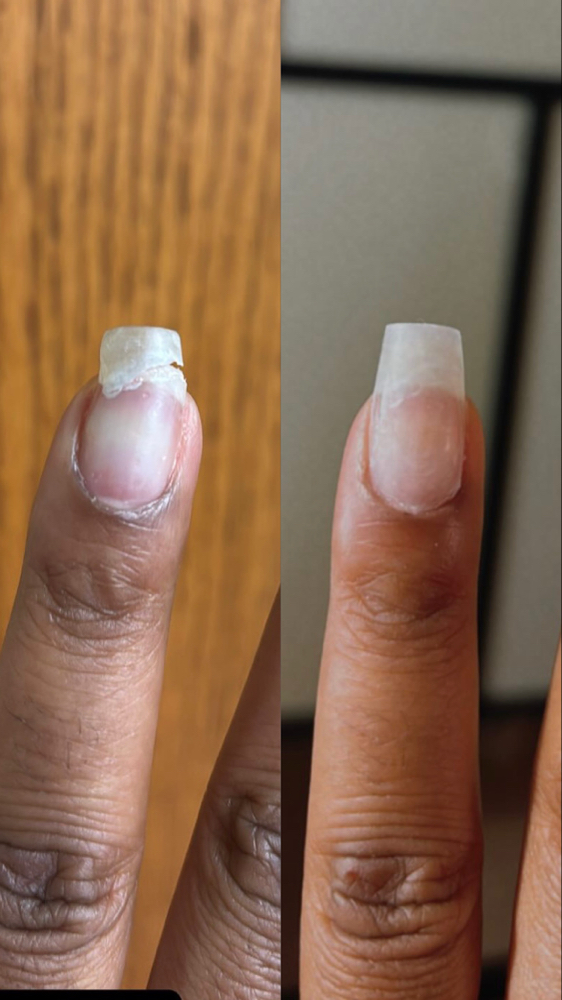 Nail Repair Service