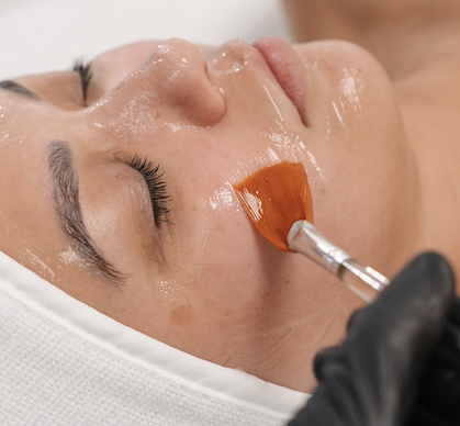 Customized Facial Peel + Vitamin A