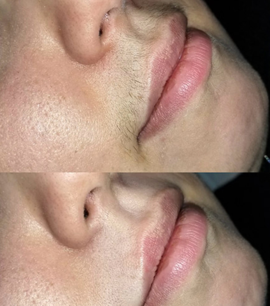 Lip Wax