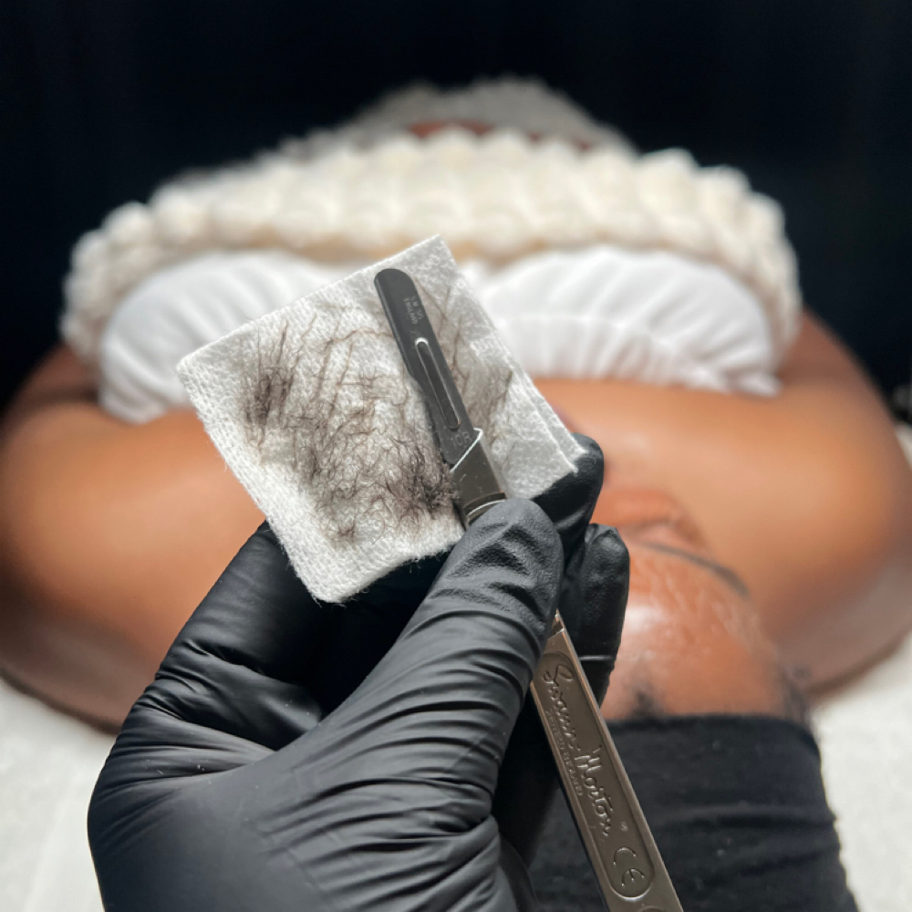 Year Of DermaGlo’s at Skin Therapy in Golden valley, MN