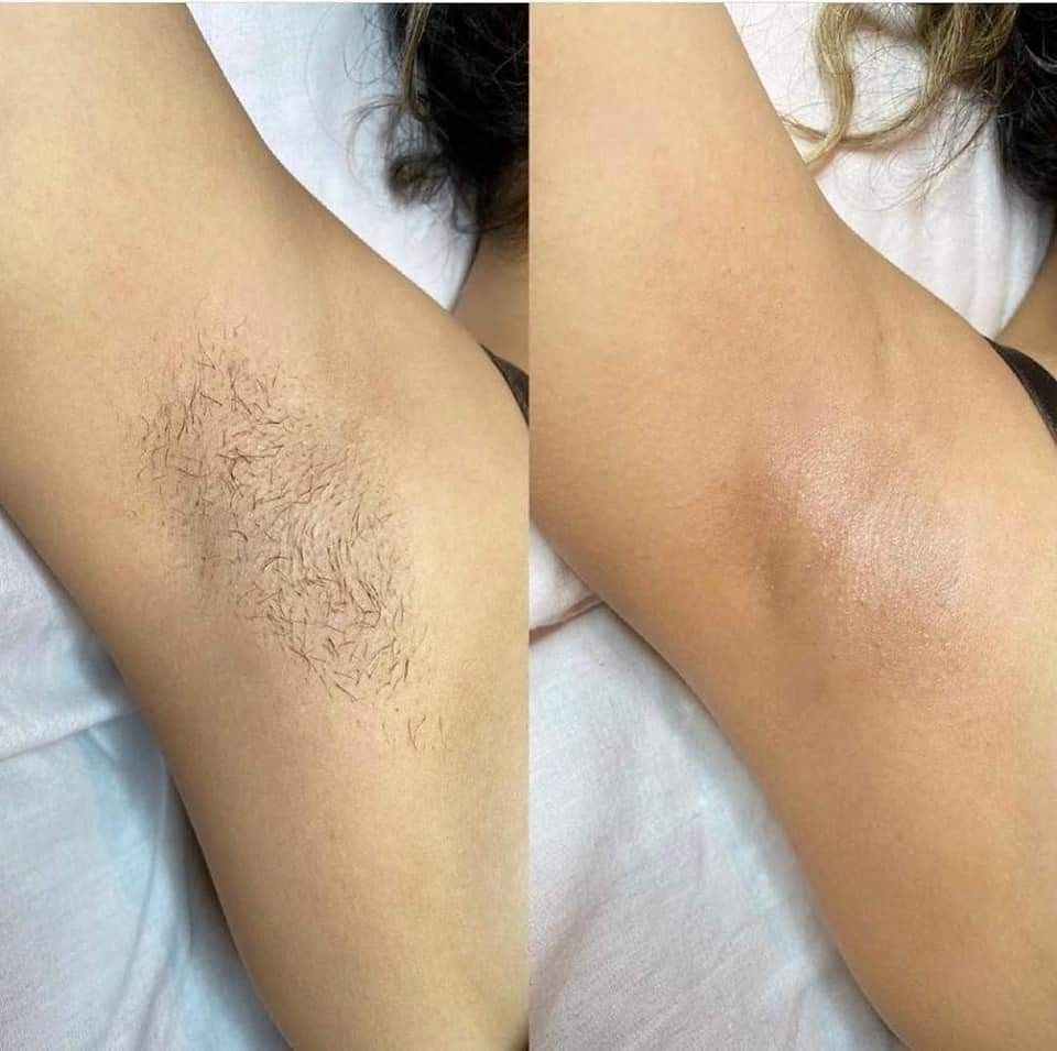 Under Arm Wax at CYNC Beauty in Long Beach, CA