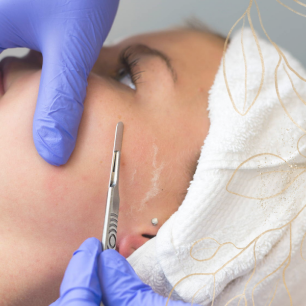 Dermplaning