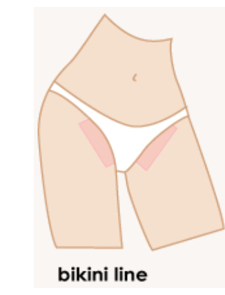 Bikni Line Waxing