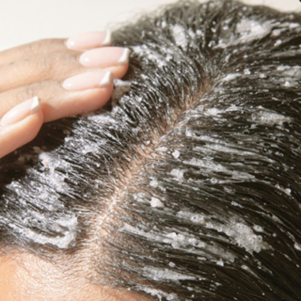 Scalp Exfoliation Treatment at Nifty Nita in Newport News, VA
