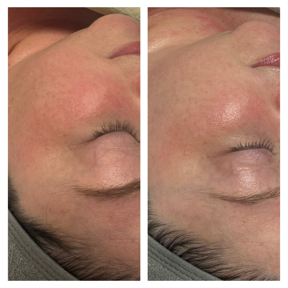 Skinceauticals Calming Facial