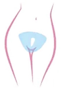Brazilian Wax (full V-area)notbutt
