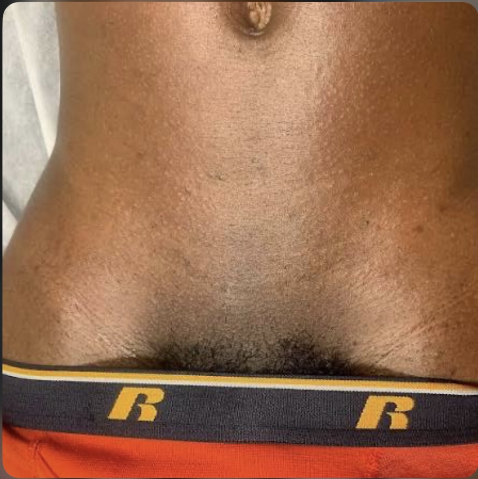 Manzilan w/o Butt Strip