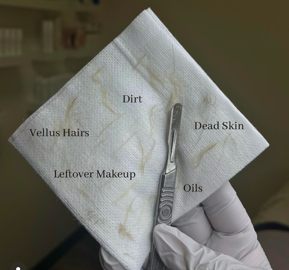 Dermaplane Add On