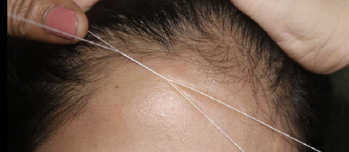 Forehead Threading
