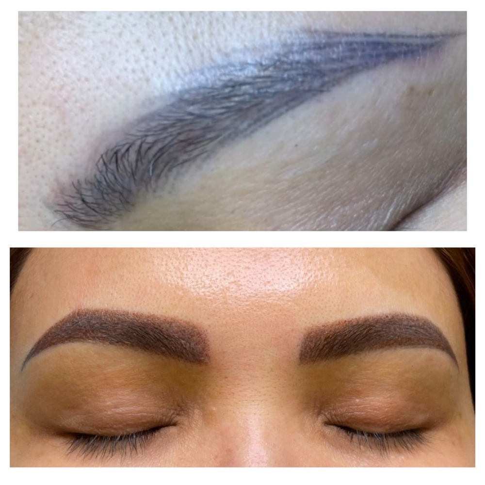 Eyebrow Correction