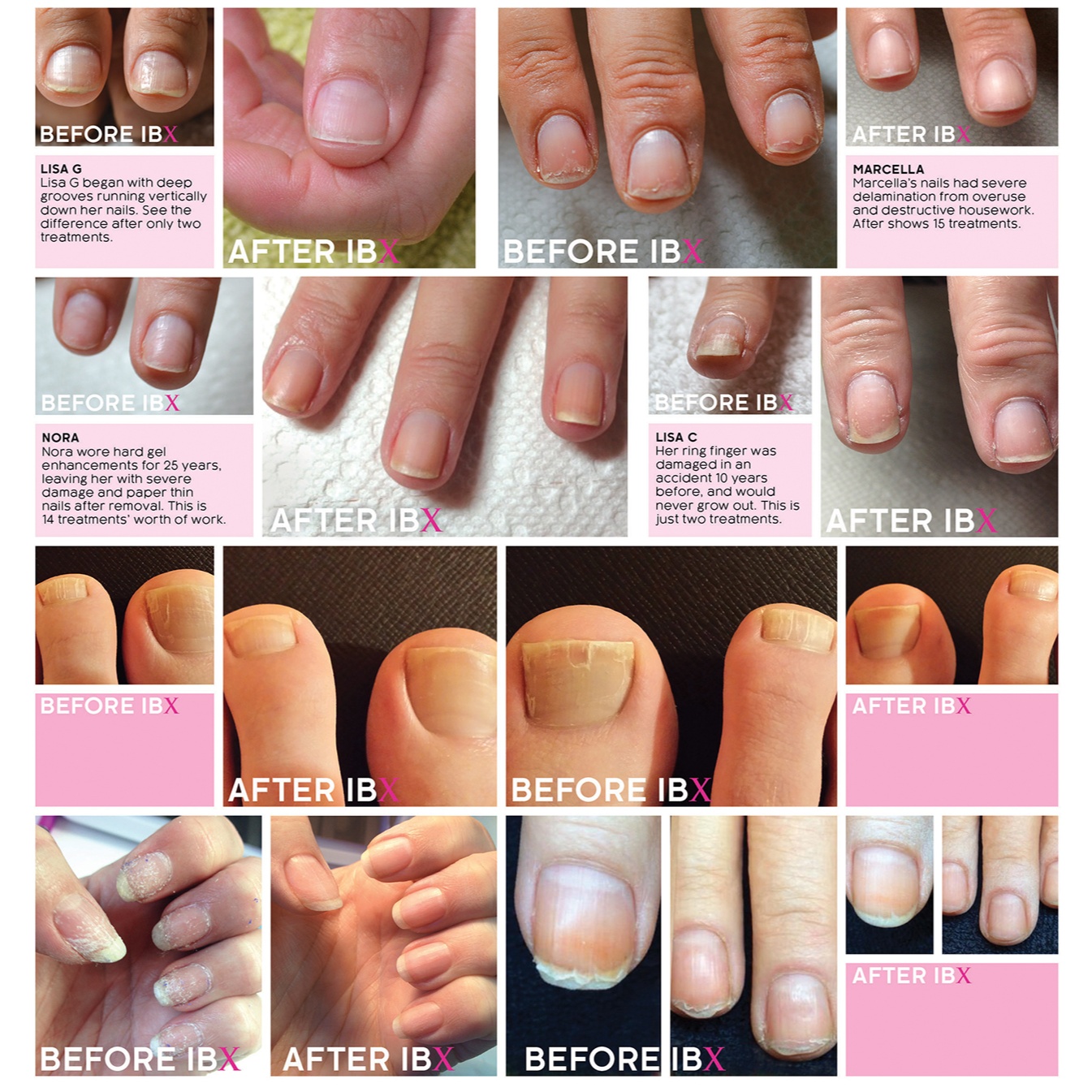 Nail Repair (IBX) at The Gloss Junkie in Mooresville, NC