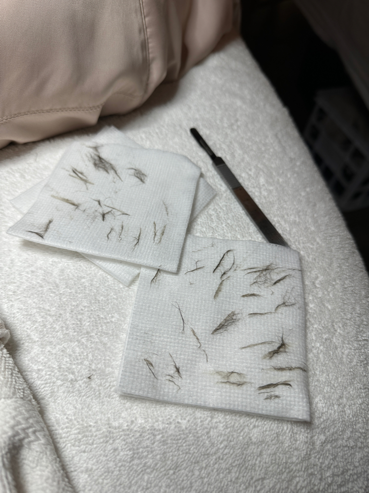 Dermaplane Facial at Luz Esthetics in Milwaukee, WI