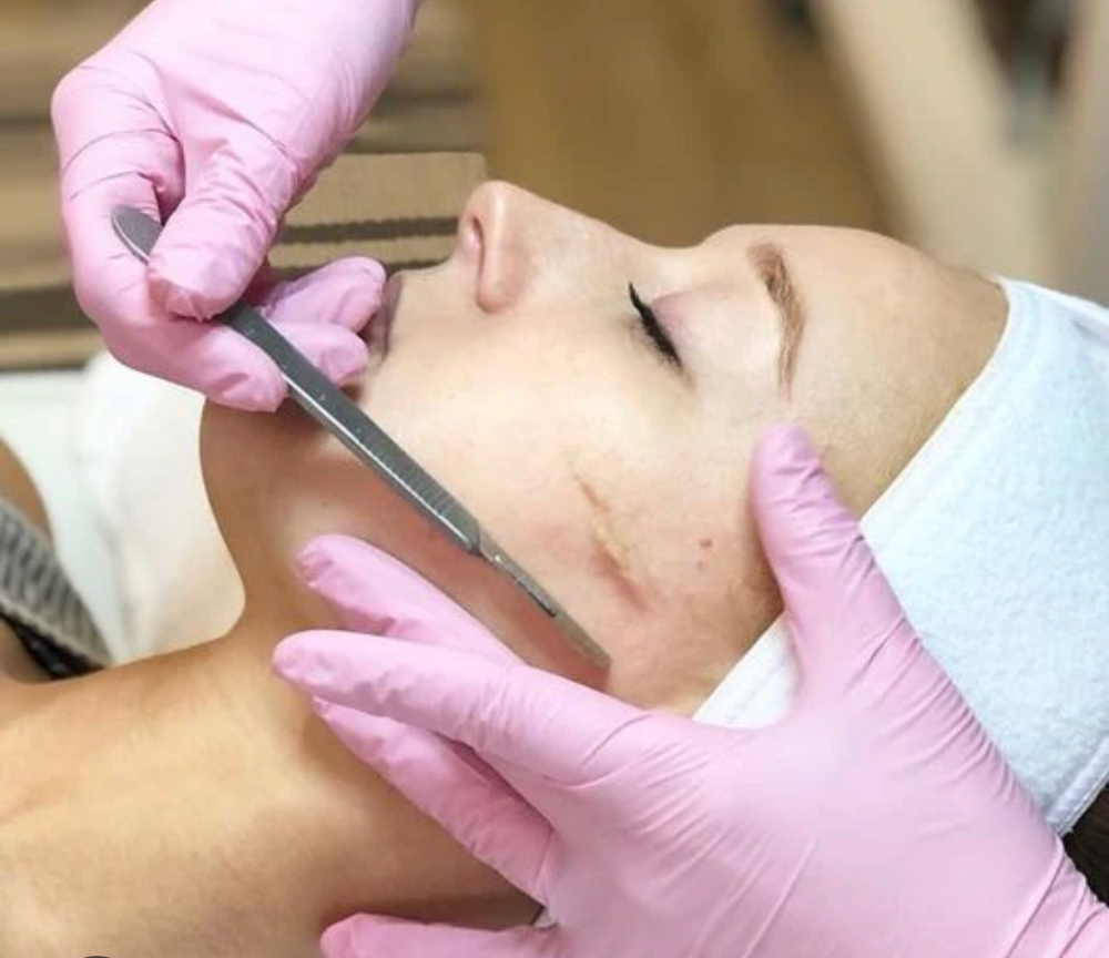 Dermaplaning (Add On For Facials)