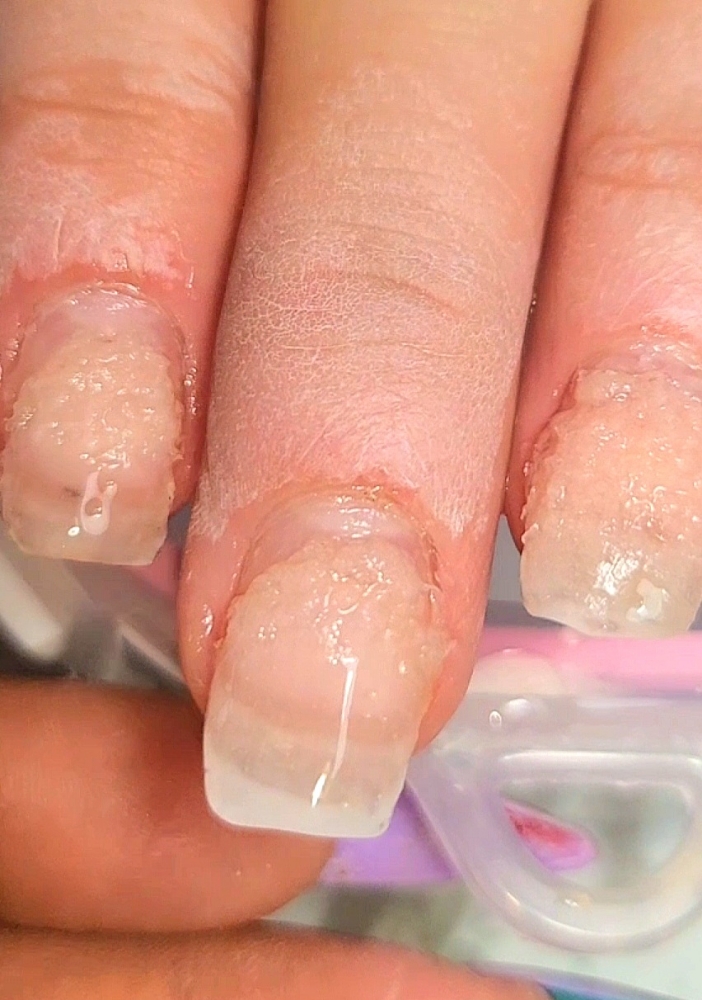 Acrylic Soak-off - NOT MY PRODUCT