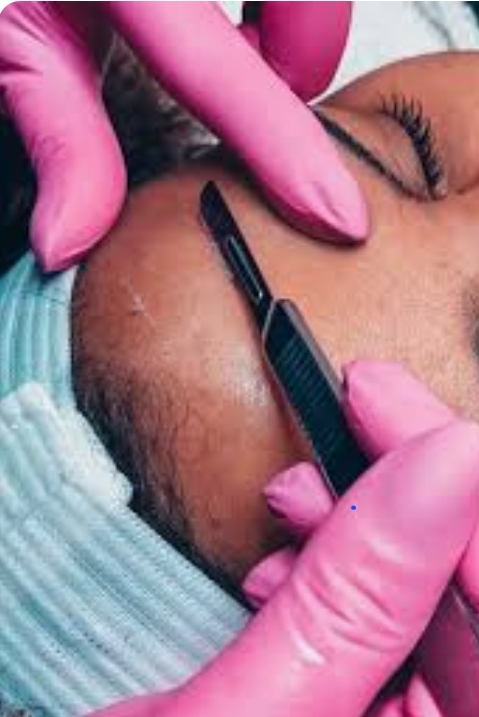 Dermaplaning Facial