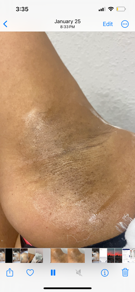 Arm Pits Wax