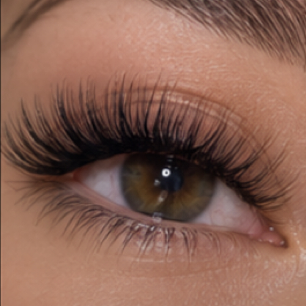 Hybrid Fill at Luma Esthetics in mechanicsburg, PA