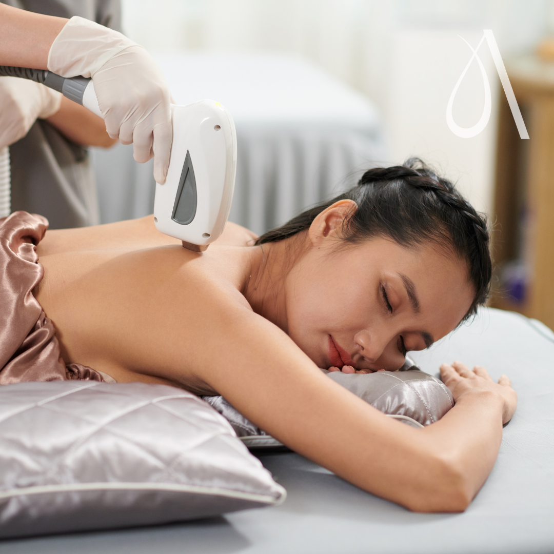 Laser - Full back - 1 session at Ambar Aesthetics in Kissimmee, FL
