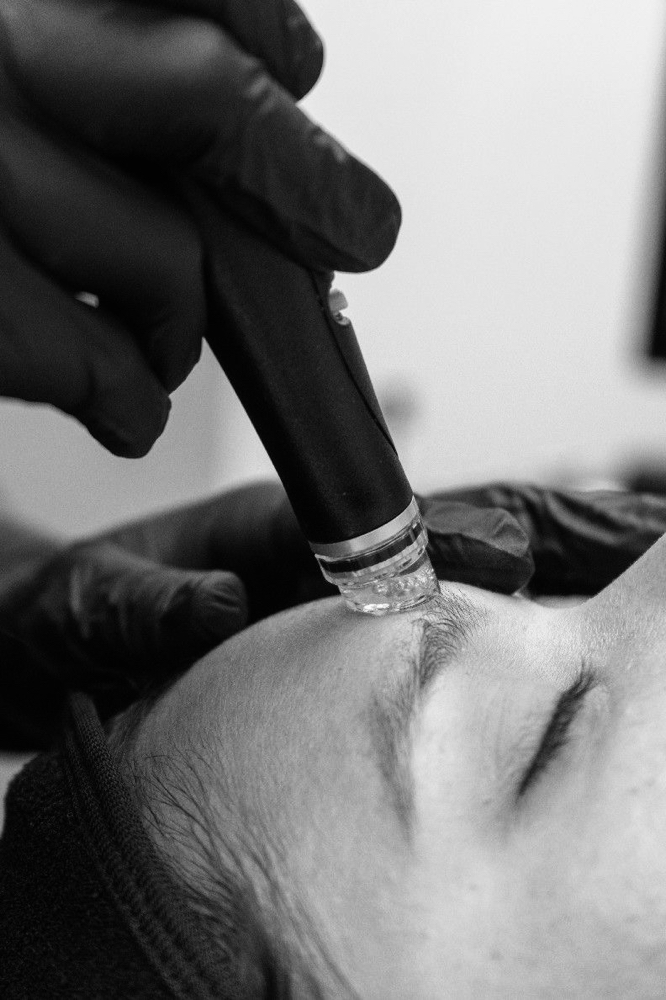 Moisture Boost Facial at Kenzy.esthetics in Hobart, IN