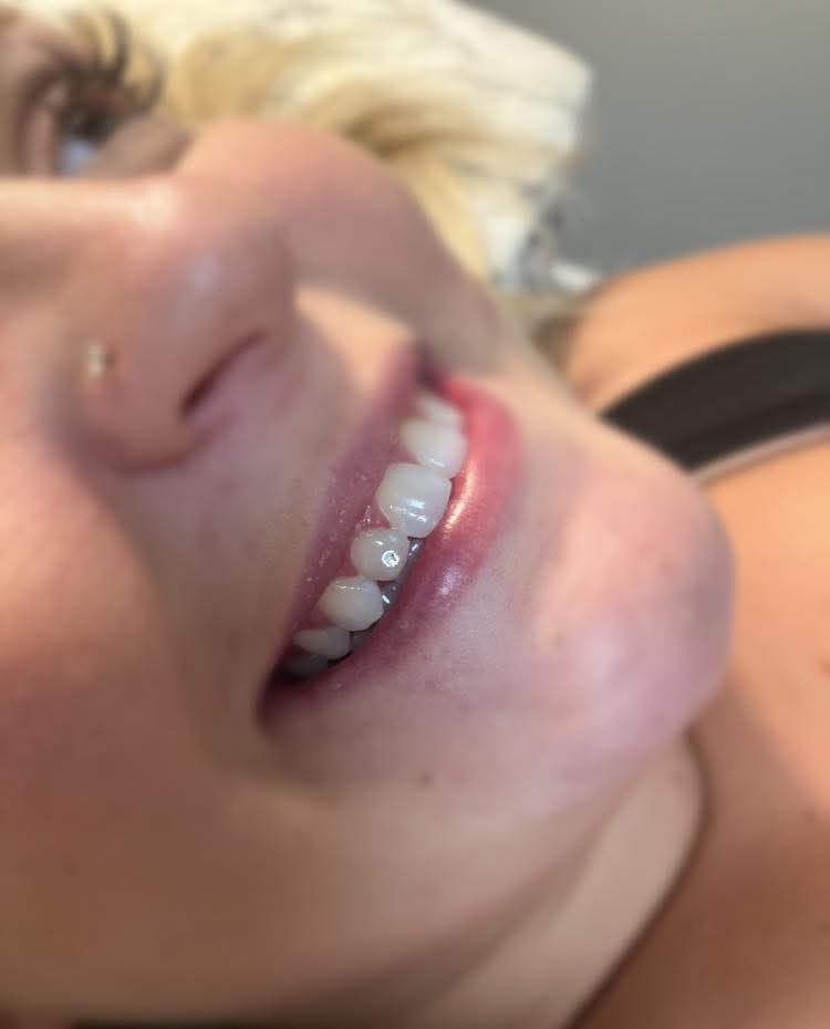 Tooth Gems
