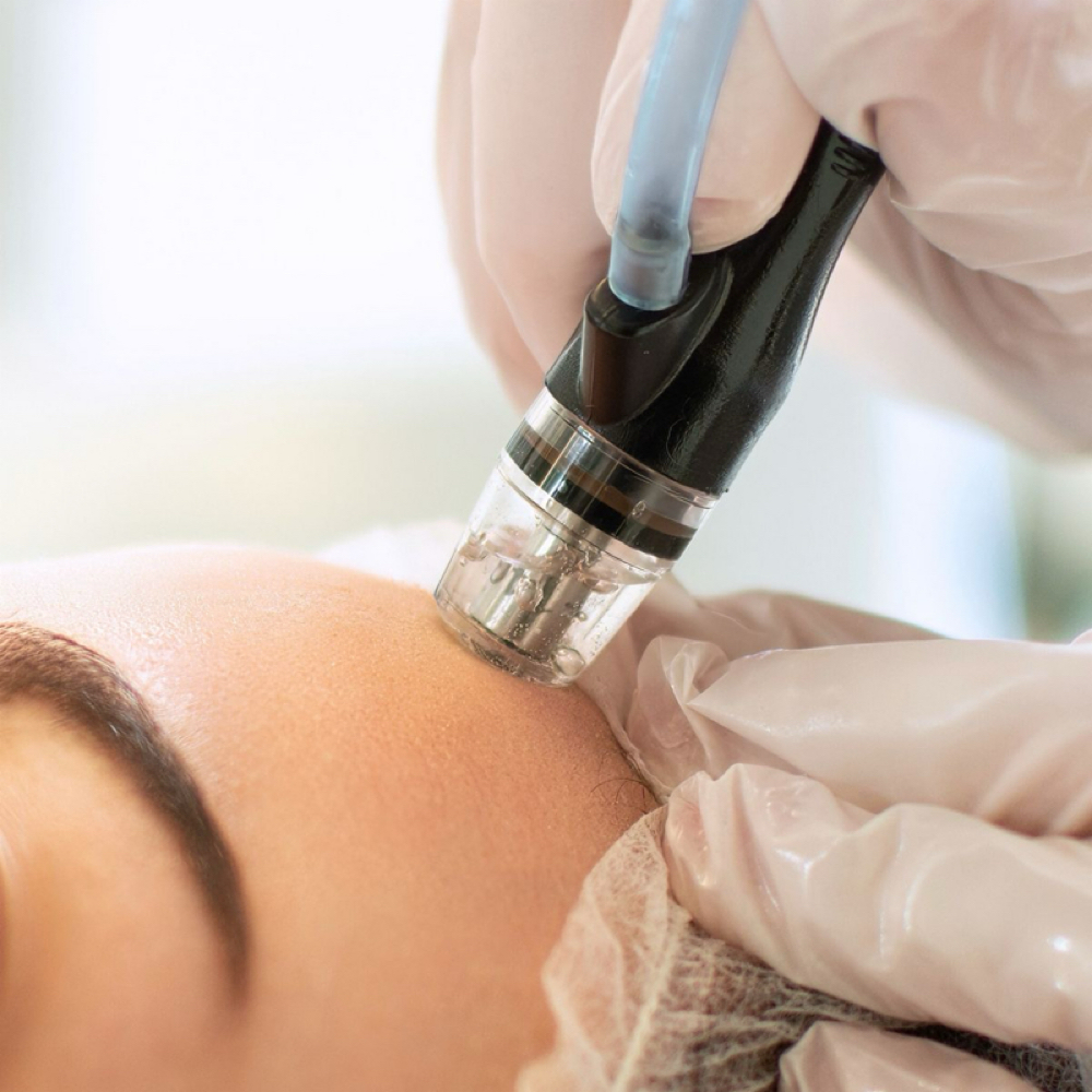 Hydro Infusion SALE $75 at Soleil Skin Beauty in Denver, CO