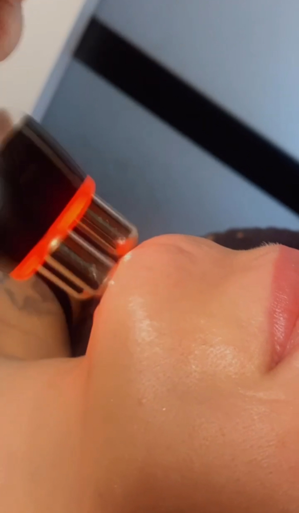 Skin Tightening Facial