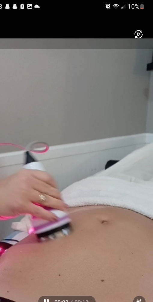 Cavitation