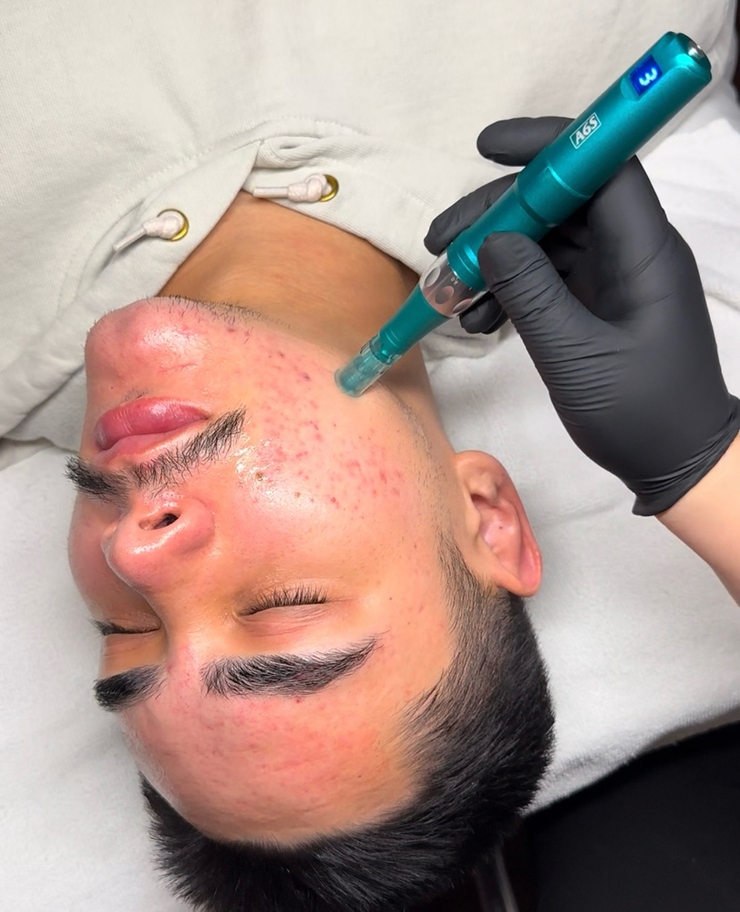 Nano Infusion Facial