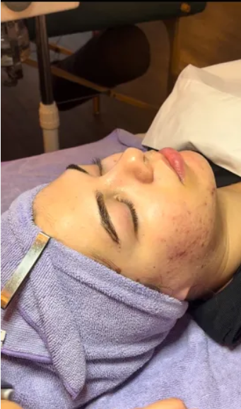 Deep Pore Facial