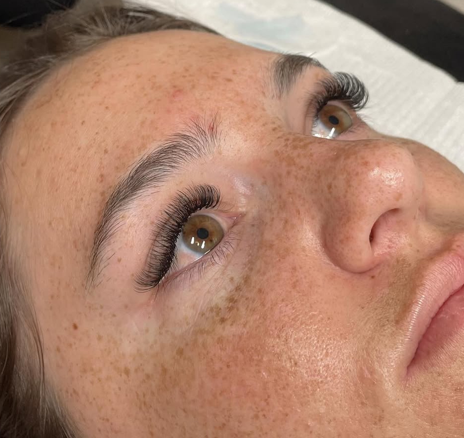 Hybrid 3 Week Fill at Bryten Gilliam Aesthetics in Brock, TX