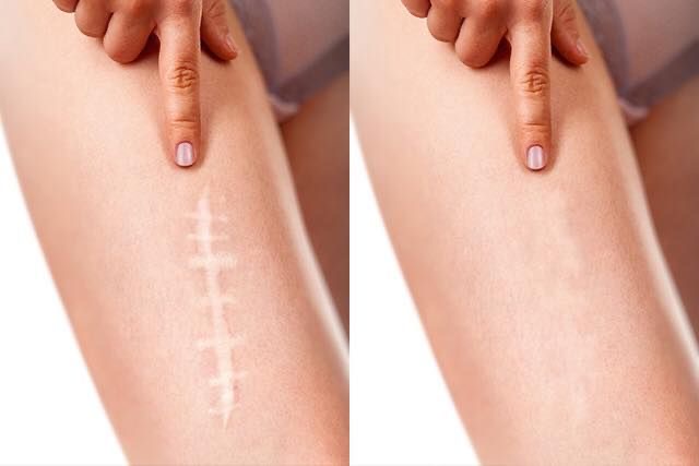 Scar Camouflage at STERLING INK & GLO in El Cajon, CA