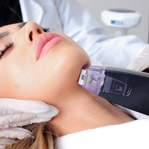 Morpheus8 - Lower Face/ Neck