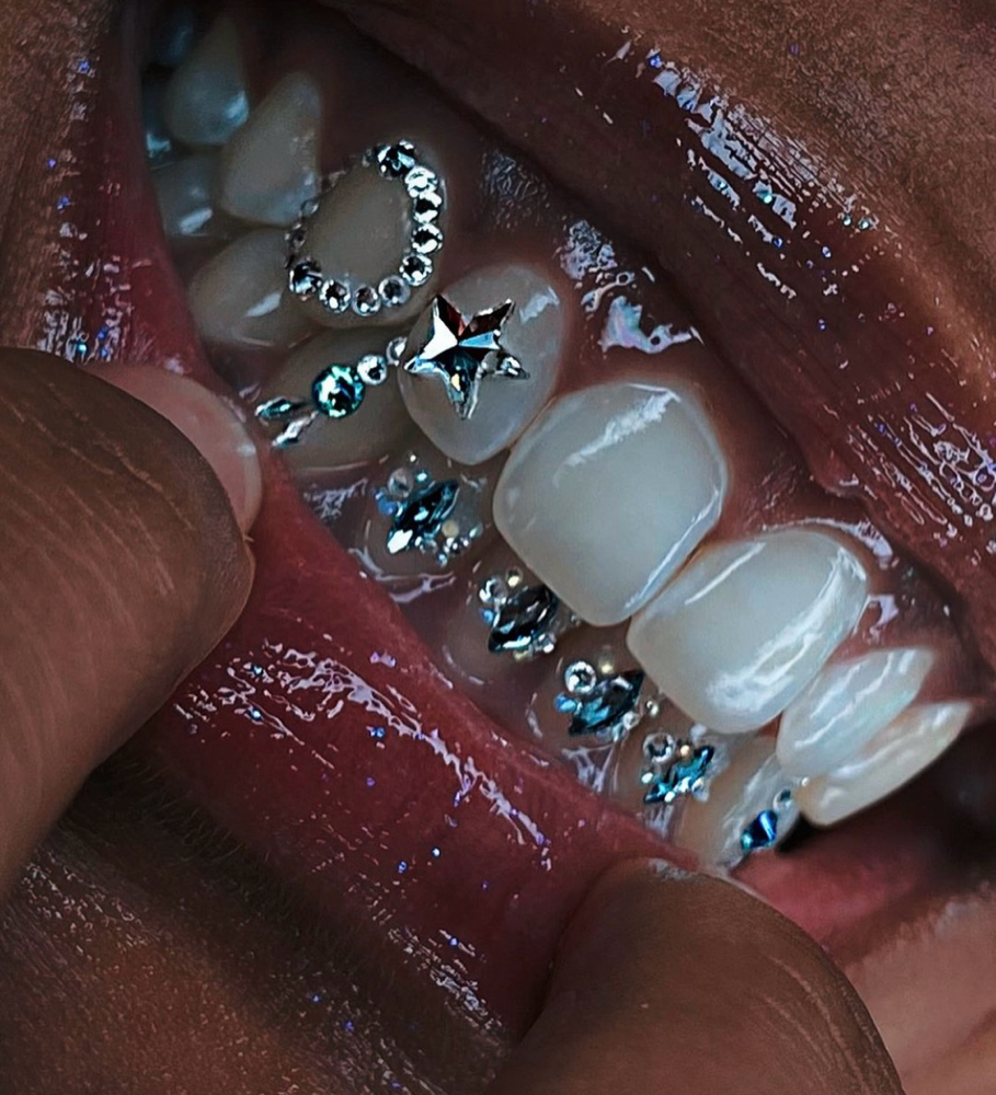 Tooth Gems Consult