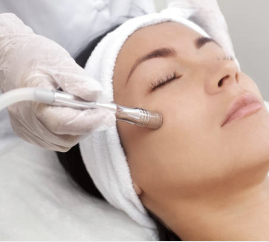 Microdermabrasion Facial