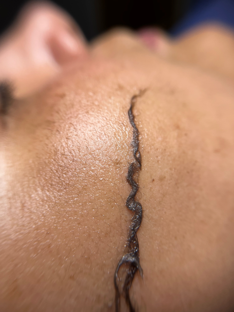 Dermaplaning Facial