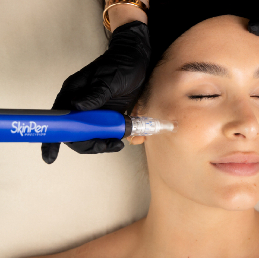 Skin Pen Microneedling at Chatuge Med Spa & Fitness in Hiawassee, GA