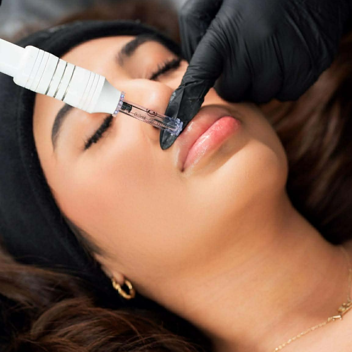 Lip Plumper at Elevé Body Aesthetics in Milliken, CO