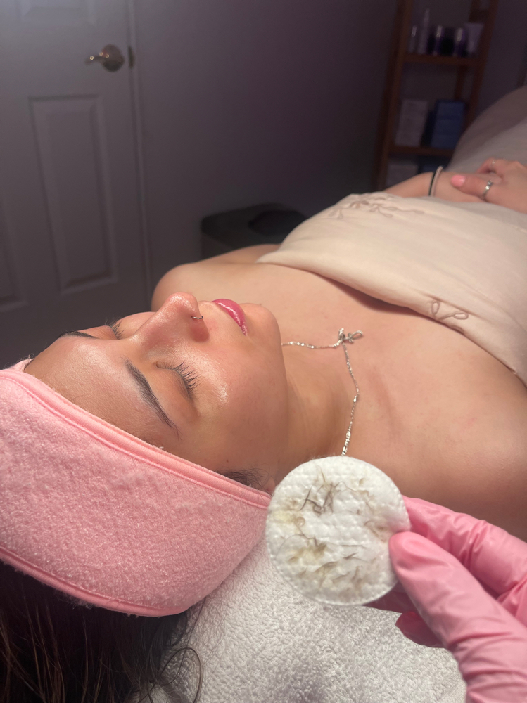 Dermaplane Without Facial at Luscious Skin in El Paso, TX