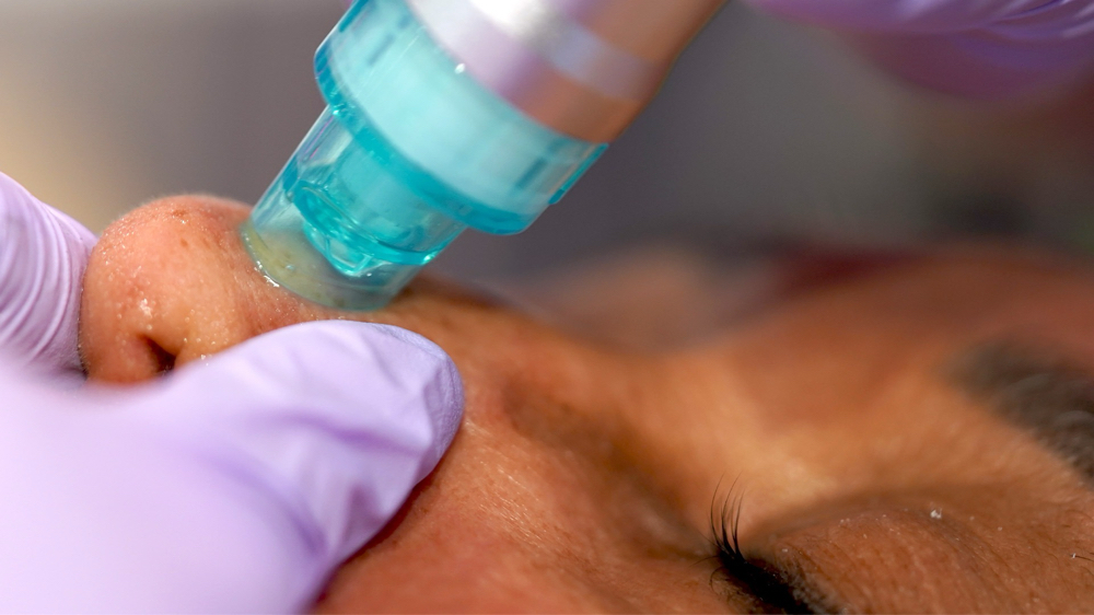 Hydrodermabrasion at Pretty Wild Salon in Campo, CA