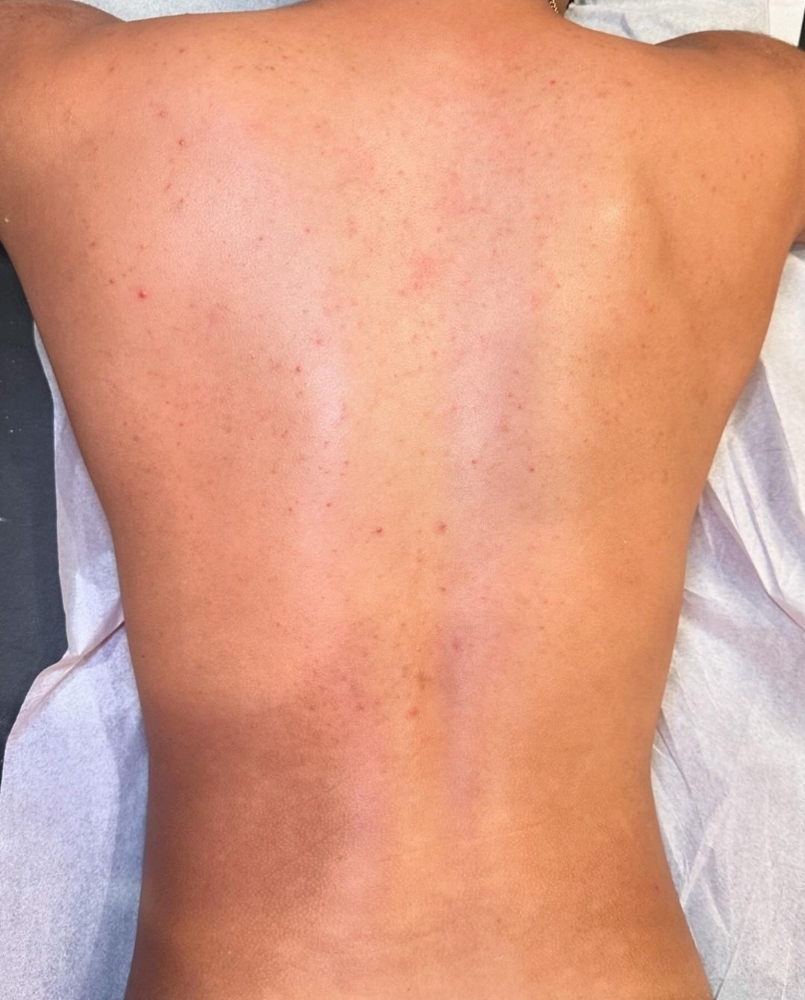 LOWER BACK