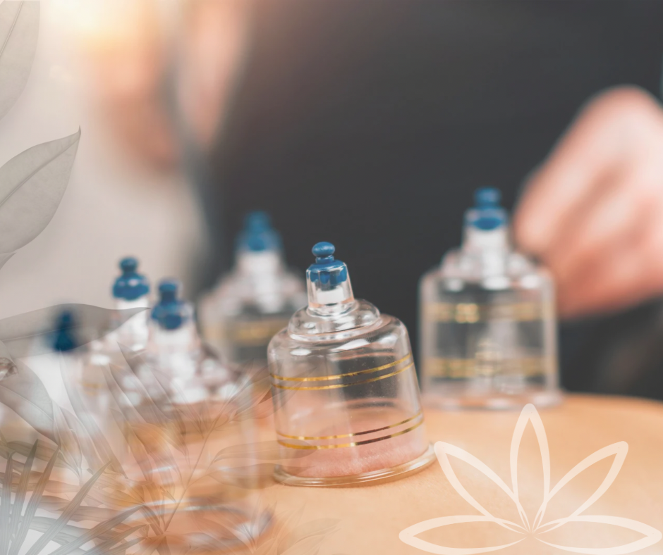 Cupping Therapy (Add On)