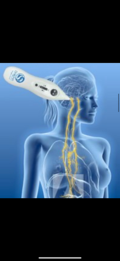 Vagal Nerve Stimulation